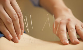 clinic-acupuncture-small